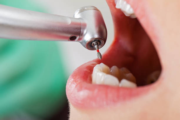 Best Weekend Emergency Dentist in Hamilton, MO